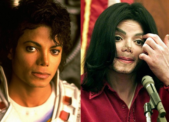 Photo of Michael Jackson before and after surgery in 2009 | Hobby Keeper Articles